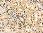 Phospho-NBS1 (Ser278) Antibody in Immunohistochemistry (Paraffin) (IHC (P))