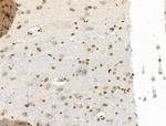 Phospho-NBS1 (Ser278) Antibody in Immunohistochemistry (Paraffin) (IHC (P))