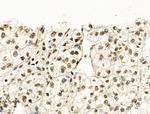 Phospho-NBS1 (Ser278) Antibody in Immunohistochemistry (Paraffin) (IHC (P))