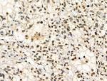 Phospho-NBS1 (Ser278) Antibody in Immunohistochemistry (Paraffin) (IHC (P))