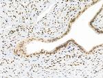 Phospho-NBS1 (Ser278) Antibody in Immunohistochemistry (Paraffin) (IHC (P))