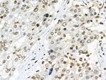 Phospho-NBS1 (Ser278) Antibody in Immunohistochemistry (Paraffin) (IHC (P))