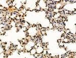 Phospho-NBS1 (Ser278) Antibody in Immunohistochemistry (Paraffin) (IHC (P))