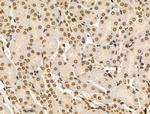 Phospho-NBS1 (Ser278) Antibody in Immunohistochemistry (Paraffin) (IHC (P))