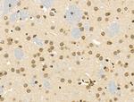 Phospho-NBS1 (Ser278) Antibody in Immunohistochemistry (Paraffin) (IHC (P))