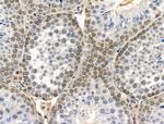 Phospho-NBS1 (Ser278) Antibody in Immunohistochemistry (Paraffin) (IHC (P))