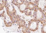 Phospho-AKT1/AKT2/AKT3 (Ser473) Antibody in Immunohistochemistry (Paraffin) (IHC (P))