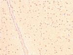 Acetyl-p53 (Lys319) Antibody in Immunohistochemistry (Paraffin) (IHC (P))