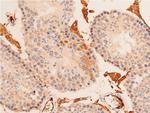 Acetyl-p53 (Lys319) Antibody in Immunohistochemistry (Paraffin) (IHC (P))