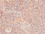 Acetyl-p53 (Lys319) Antibody in Immunohistochemistry (Paraffin) (IHC (P))