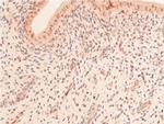 Acetyl-p53 (Lys319) Antibody in Immunohistochemistry (Paraffin) (IHC (P))