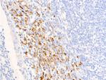 Phospho-Glucocorticoid Receptor (Ser211) Antibody in Immunohistochemistry (Paraffin) (IHC (P))