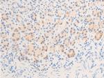 Phospho-Glucocorticoid Receptor (Ser211) Antibody in Immunohistochemistry (Paraffin) (IHC (P))