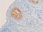 Phospho-Glucocorticoid Receptor (Ser211) Antibody in Immunohistochemistry (Paraffin) (IHC (P))