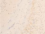 Phospho-SYK (Tyr323) Antibody in Immunohistochemistry (Paraffin) (IHC (P))