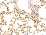 Phospho-SYK (Tyr323) Antibody in Immunohistochemistry (Paraffin) (IHC (P))