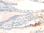 Phospho-SYK (Tyr323) Antibody in Immunohistochemistry (Paraffin) (IHC (P))