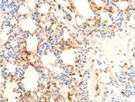 Phospho-SYK (Tyr323) Antibody in Immunohistochemistry (Paraffin) (IHC (P))