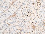 Phospho-SYK (Tyr323) Antibody in Immunohistochemistry (Paraffin) (IHC (P))