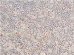 Phospho-Chk1 (Ser280) Antibody in Immunohistochemistry (Paraffin) (IHC (P))