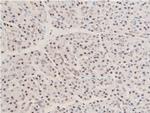 Phospho-Chk1 (Ser280) Antibody in Immunohistochemistry (Paraffin) (IHC (P))