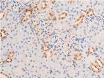 Phospho-Chk1 (Ser280) Antibody in Immunohistochemistry (Paraffin) (IHC (P))