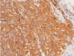 Phospho-Chk1 (Ser317) Antibody in Immunohistochemistry (Paraffin) (IHC (P))