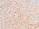 Phospho-Chk1 (Ser317) Antibody in Immunohistochemistry (Paraffin) (IHC (P))