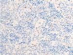 Phospho-Chk1 (Ser317) Antibody in Immunohistochemistry (Paraffin) (IHC (P))