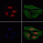 Phospho-HDAC3 (Ser424) Antibody in Immunocytochemistry (ICC/IF)