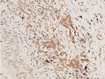 Phospho-TAK1 (Thr187) Antibody in Immunohistochemistry (Paraffin) (IHC (P))