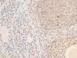 Phospho-TAK1 (Thr187) Antibody in Immunohistochemistry (Paraffin) (IHC (P))