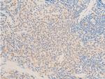 Phospho-TAK1 (Thr187) Antibody in Immunohistochemistry (Paraffin) (IHC (P))