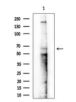 Phospho-Estrogen Receptor alpha (Ser167) Antibody in Western Blot (WB)