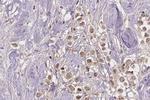 Phospho-Estrogen Receptor alpha (Ser167) Antibody in Immunohistochemistry (Paraffin) (IHC (P))