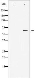 Phospho-Estrogen Receptor alpha (Ser167) Antibody in Western Blot (WB)