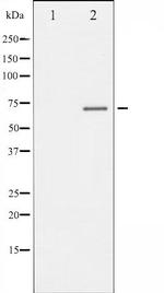 Phospho-Estrogen Receptor alpha (Ser106) Antibody in Western Blot (WB)