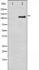 Phospho-CD61 (Tyr785) Antibody in Western Blot (WB)