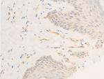 Phospho-ICAM-1 (Tyr512) Antibody in Immunohistochemistry (Paraffin) (IHC (P))