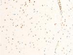 Phospho-ICAM-1 (Tyr512) Antibody in Immunohistochemistry (Paraffin) (IHC (P))