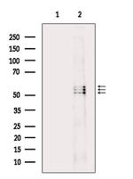 Phospho-Lyn (Tyr508) Antibody in Western Blot (WB)