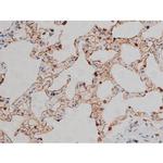 Phospho-Lyn (Tyr508) Antibody in Immunohistochemistry (Paraffin) (IHC (P))