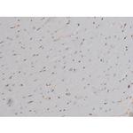 Phospho-Lyn (Tyr508) Antibody in Immunohistochemistry (Paraffin) (IHC (P))