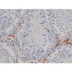 Phospho-Lyn (Tyr508) Antibody in Immunohistochemistry (Paraffin) (IHC (P))