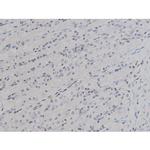 Phospho-Lyn (Tyr508) Antibody in Immunohistochemistry (Paraffin) (IHC (P))