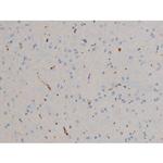 Phospho-BCL-2 (Ser70) Antibody in Immunohistochemistry (Paraffin) (IHC (P))