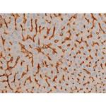 Phospho-BCL-2 (Ser70) Antibody in Immunohistochemistry (Paraffin) (IHC (P))