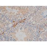 Phospho-BCL-2 (Ser70) Antibody in Immunohistochemistry (Paraffin) (IHC (P))