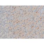 Phospho-BCL-2 (Ser70) Antibody in Immunohistochemistry (Paraffin) (IHC (P))