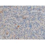 Phospho-BCL-2 (Ser70) Antibody in Immunohistochemistry (Paraffin) (IHC (P))